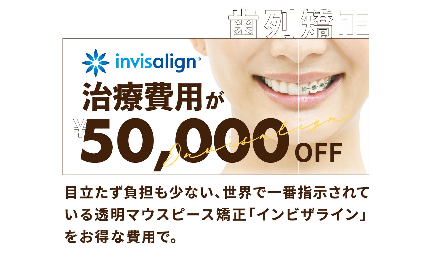 【歯列矯正】インビザライン　治療費用が ¥50,000 OFF